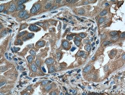 14-3-3 epsilon Rabbit anti-Human, Mouse, Rat, Polyclonal, Proteintech:Antibodies:Primary