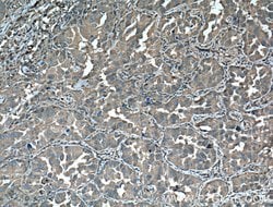 14-3-3 epsilon Rabbit anti-Human, Mouse, Rat, Polyclonal, Proteintech:Antibodies:Primary