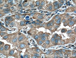 14-3-3 epsilon Rabbit anti-Human, Mouse, Rat, Polyclonal, Proteintech:Antibodies:Primary