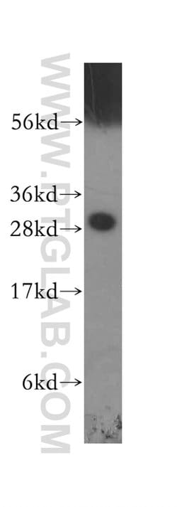 14-3-3 epsilon Rabbit anti-Human, Mouse, Rat, Polyclonal, Proteintech:Antibodies:Primary