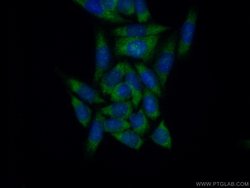 EIF1AX Rabbit anti-Human, Mouse, Rat, Polyclonal, Proteintech:Antibodies:Primary