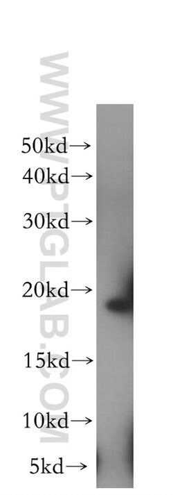 EIF1AX Rabbit anti-Human, Mouse, Rat, Polyclonal, Proteintech:Antibodies:Primary