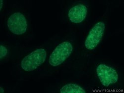 CBX3 Rabbit anti-Human, Mouse, Rat, Polyclonal, Proteintech 150 &mu;L | Buy Online | Proteintech Group Inc | Fisher Scientific