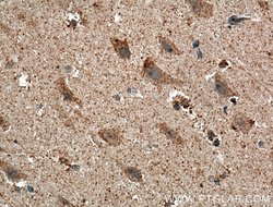 MCHR1 Rabbit anti-Human, Mouse, Rat, Polyclonal, Proteintech 150 &mu;L;