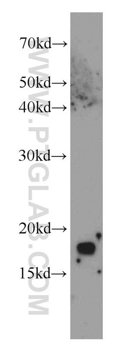 CPI17 Rabbit anti-Human, Polyclonal, Proteintech 150 &mu;L; Unconjugated:Antibodies,