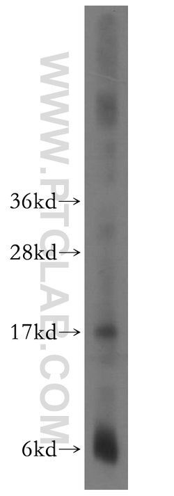 CPI17 Rabbit anti-Human, Polyclonal, Proteintech 150 &mu;L; Unconjugated:Antibodies,