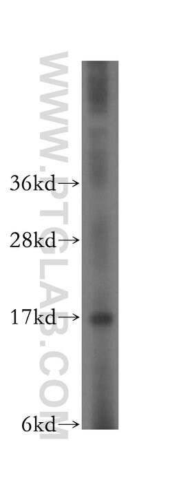 CPI17 Rabbit anti-Human, Polyclonal, Proteintech 150 &mu;L; Unconjugated:Antibodies,