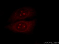 MALT1 Rabbit anti-Human, Mouse, Rat, Polyclonal, Proteintech 150 &mu;L;