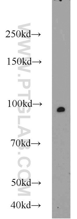 MALT1 Rabbit anti-Human, Mouse, Rat, Polyclonal, Proteintech 150 &mu;L;