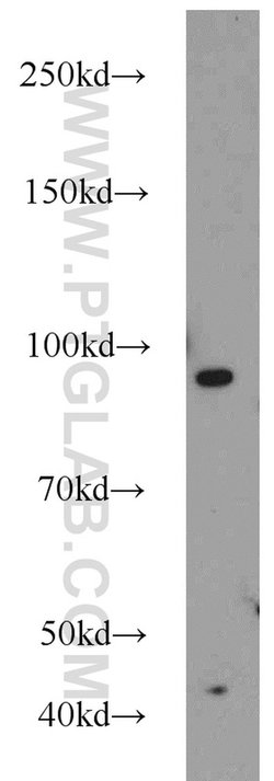 MALT1 Rabbit anti-Human, Mouse, Rat, Polyclonal, Proteintech 150 &mu;L;
