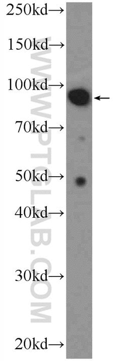 MALT1 Rabbit anti-Human, Mouse, Rat, Polyclonal, Proteintech 150 &mu;L;