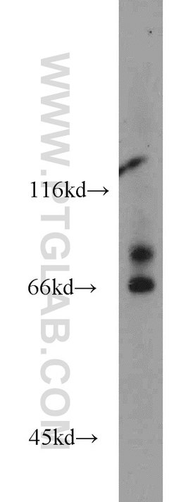Proteintech VPS52 Rabbit anti-Human, Mouse, Rat, Polyclonal, Proteintech