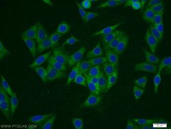 TTC1 Rabbit anti-Human, Mouse, Rat, Polyclonal, Proteintech 150 &mu;L;