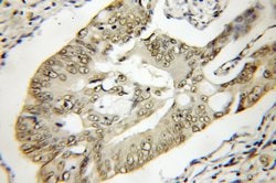 TTC1 Rabbit anti-Human, Mouse, Rat, Polyclonal, Proteintech 150 &mu;L;