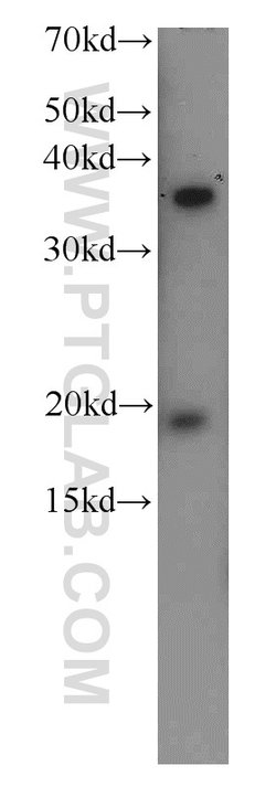 TTC1 Rabbit anti-Human, Mouse, Rat, Polyclonal, Proteintech 150 &mu;L;