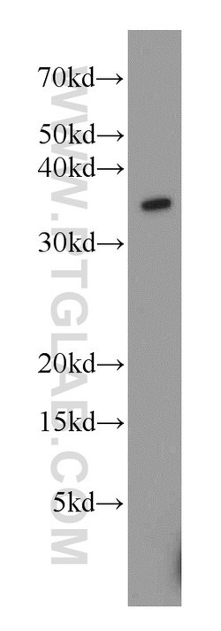 TTC1 Rabbit anti-Human, Mouse, Rat, Polyclonal, Proteintech 150 &mu;L;