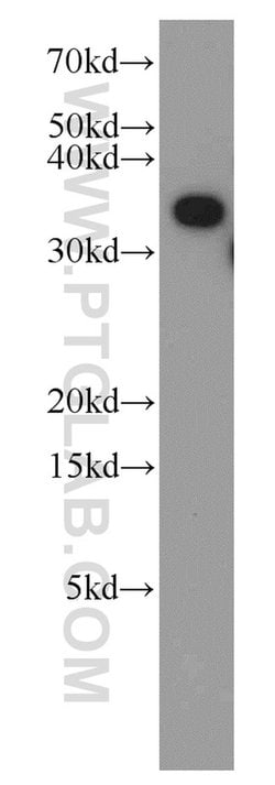 TTC1 Rabbit anti-Human, Mouse, Rat, Polyclonal, Proteintech 150 &mu;L;