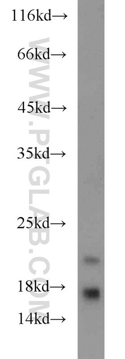 ARPP-19 Rabbit anti-Human, Mouse, Rat, Polyclonal, Proteintech 150 &mu;L;