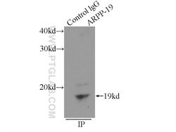 ARPP-19 Rabbit anti-Human, Mouse, Rat, Polyclonal, Proteintech 150 &mu;L;