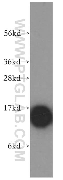 Profilin 1 Rabbit anti-Human, Mouse, Rat, Polyclonal, Proteintech:Antibodies:Primary