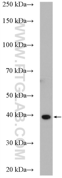 PLEK2 Rabbit anti-Human, Mouse, Rat, Polyclonal, Proteintech:Antibodies:Primary