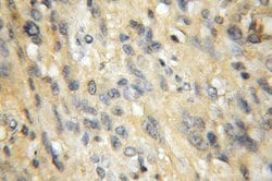 EXOC1 Rabbit anti-Human, Mouse, Rat, Polyclonal, Proteintech 150 &mu;L;