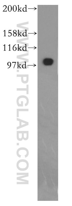 EXOC1 Rabbit anti-Human, Mouse, Rat, Polyclonal, Proteintech 150 &mu;L;