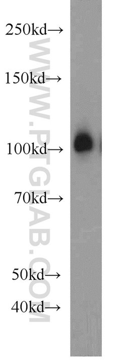 EXOC1 Rabbit anti-Human, Mouse, Rat, Polyclonal, Proteintech 150 &mu;L;