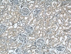 TAX1BP3 Rabbit anti-Human, Mouse, Rat, Polyclonal, Proteintech 150 &mu;L;