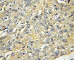 TAX1BP3 Rabbit anti-Human, Mouse, Rat, Polyclonal, Proteintech 150 &mu;L;
