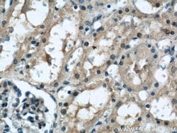 TAX1BP3 Rabbit anti-Human, Mouse, Rat, Polyclonal, Proteintech 150 &mu;L;