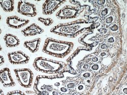 TAX1BP3 Rabbit anti-Human, Mouse, Rat, Polyclonal, Proteintech 150 &mu;L;