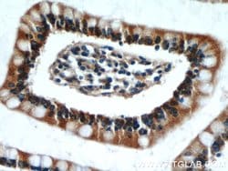 TAX1BP3 Rabbit anti-Human, Mouse, Rat, Polyclonal, Proteintech 150 &mu;L;