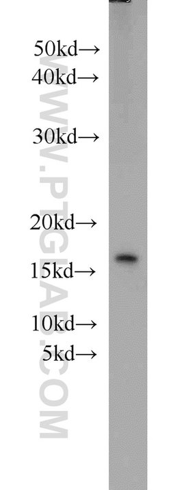 TAX1BP3 Rabbit anti-Human, Mouse, Rat, Polyclonal, Proteintech 150 &mu;L;