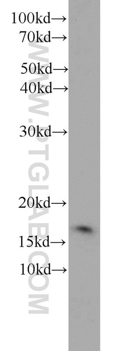 TAX1BP3 Rabbit anti-Human, Mouse, Rat, Polyclonal, Proteintech 150 &mu;L;