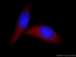 HMGN1 Rabbit anti-Human, Mouse, Rat, Polyclonal, Proteintech 150 &mu;L;