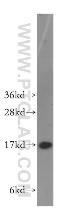 HMGN1 Rabbit anti-Human, Mouse, Rat, Polyclonal, Proteintech 150 &mu;L;