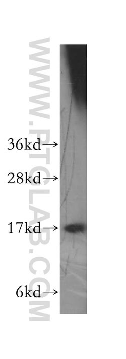 HMGN1 Rabbit anti-Human, Mouse, Rat, Polyclonal, Proteintech 150 &mu;L;