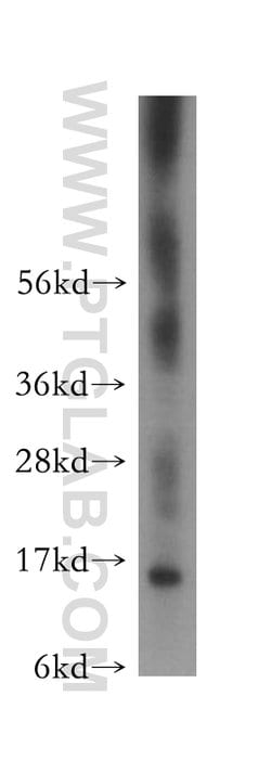 FKBP2 Rabbit anti-Human, Mouse, Rat, Polyclonal, Proteintech:Antibodies:Primary