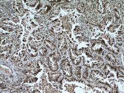 CDK9 Rabbit anti-Human, Mouse, Rat, Polyclonal, Proteintech 150 &mu;L;