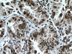 CDK9 Rabbit anti-Human, Mouse, Rat, Polyclonal, Proteintech 150 &mu;L;