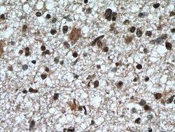 CDK9 Rabbit anti-Human, Mouse, Rat, Polyclonal, Proteintech 150 &mu;L;