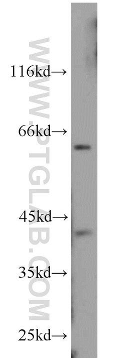 CDK9 Rabbit anti-Human, Mouse, Rat, Polyclonal, Proteintech 150 &mu;L;