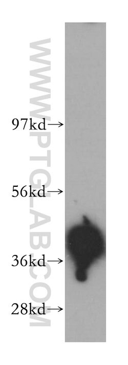 CDK9 Rabbit anti-Human, Mouse, Rat, Polyclonal, Proteintech 150 &mu;L;