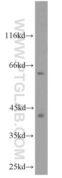 CDK9 Rabbit anti-Human, Mouse, Rat, Polyclonal, Proteintech 150 &mu;L;