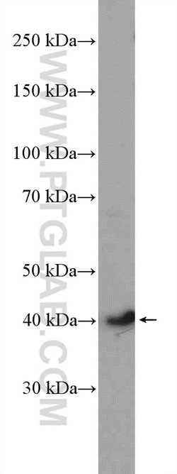 CDK9 Rabbit anti-Human, Mouse, Rat, Polyclonal, Proteintech 150 &mu;L;