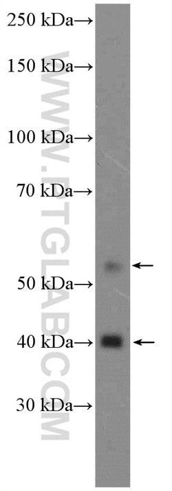 CDK9 Rabbit anti-Human, Mouse, Rat, Polyclonal, Proteintech 150 &mu;L;