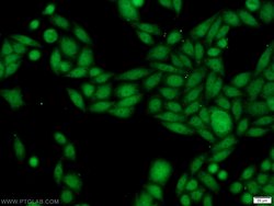 SSB Rabbit anti-Human, Mouse, Rat, Polyclonal, Proteintech:Antibodies:Primary