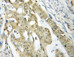 SSB Rabbit anti-Human, Mouse, Rat, Polyclonal, Proteintech:Antibodies:Primary