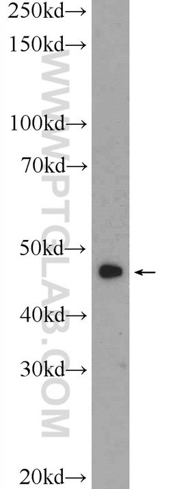 SSB Rabbit anti-Human, Mouse, Rat, Polyclonal, Proteintech:Antibodies:Primary